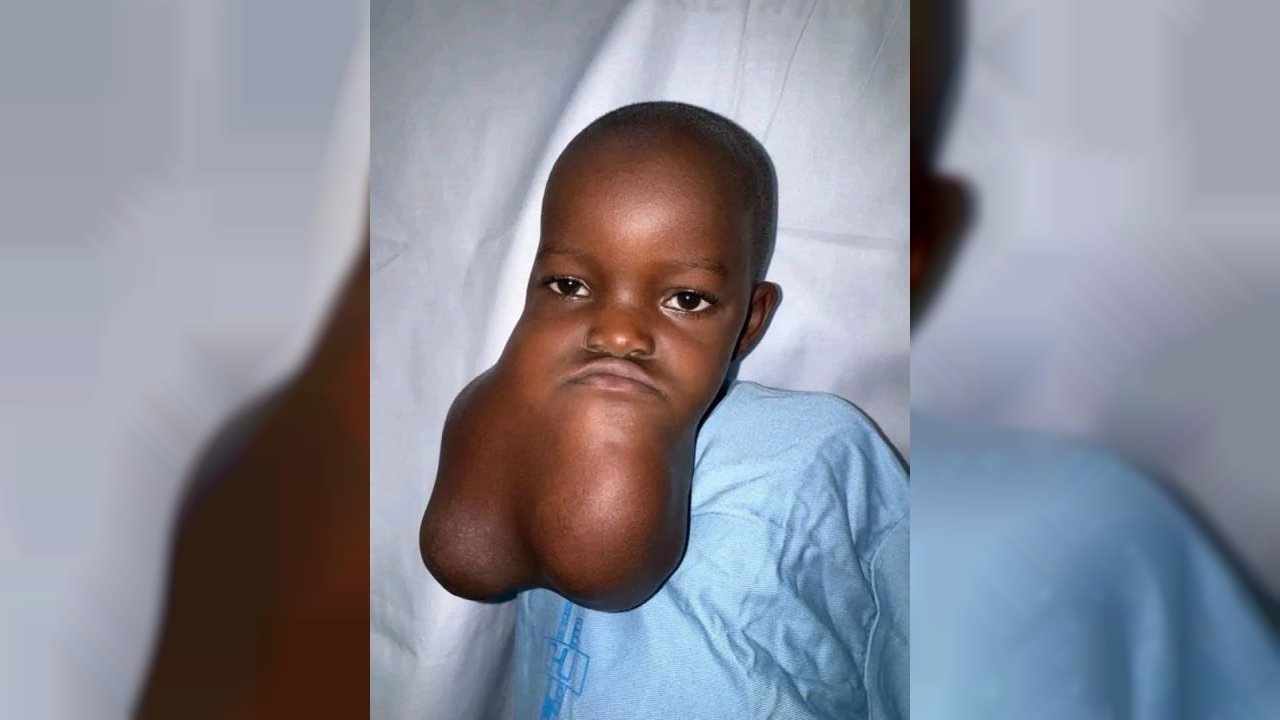 aidons le petit Hamed à revivre