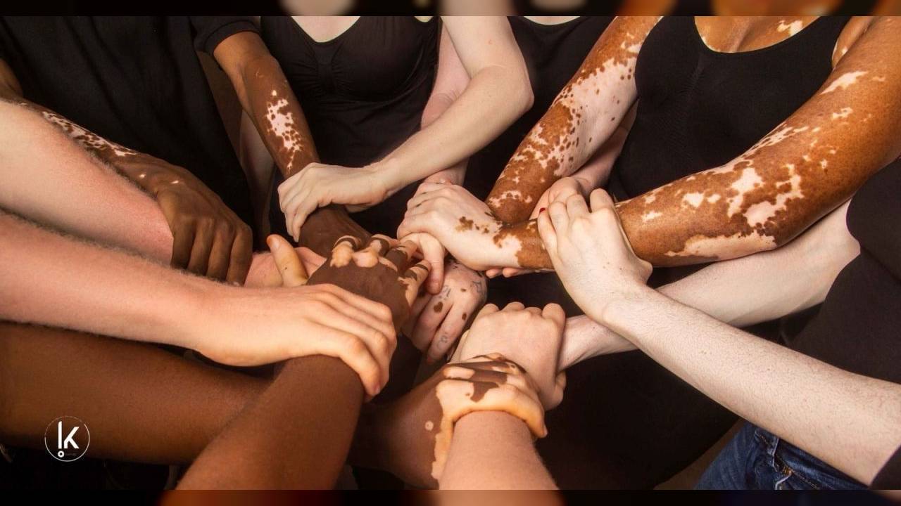 KLOLÈ PROJET