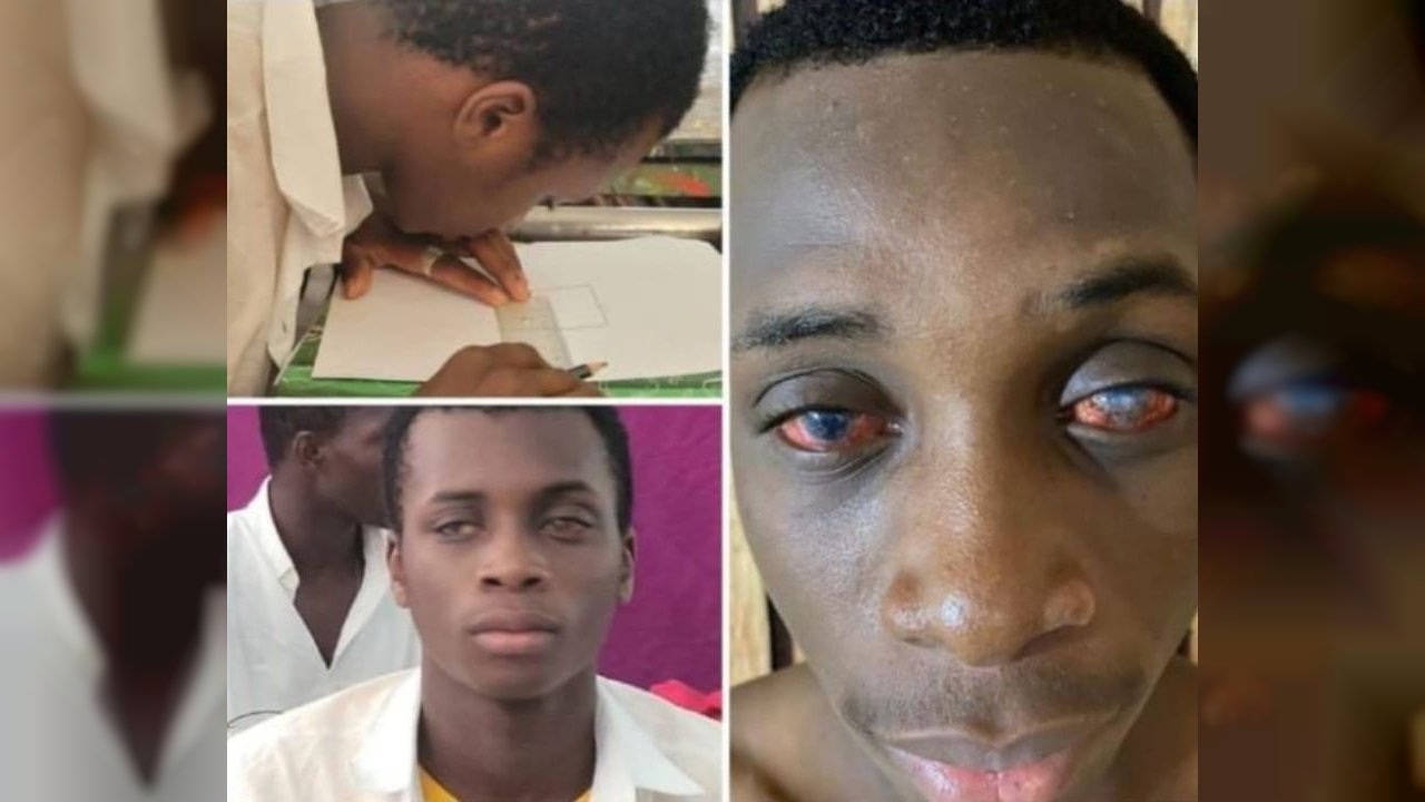 Sauvons la vue de Sorro