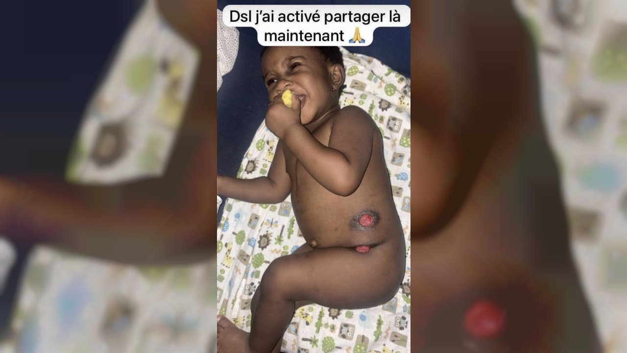 La petite Bérénice